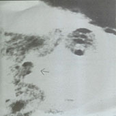 q04